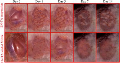 Enhanced Antifungal and Wound Healing Efficacy of Statistically Optimized, Physicochemically Evaluated Econazole-Triamcinolone Loaded Silica Nanoparticles